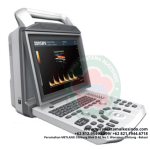 USG Color Doppler